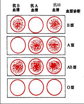 abo血型鉴定,即指abh血型抗原的检测.